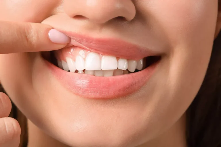 افضل عيادة لتوريد اللثة بالليزر بجدة