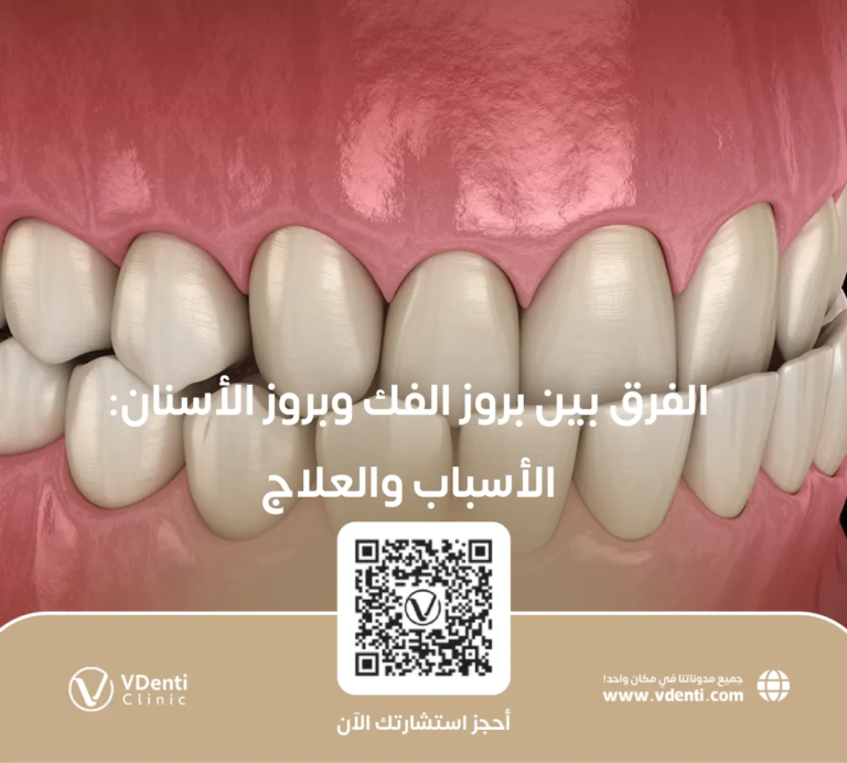 الفرق بين بروز الفك وبروز الأسنان