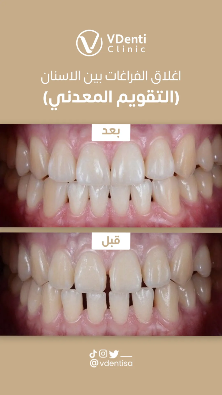 التقويم المعدني