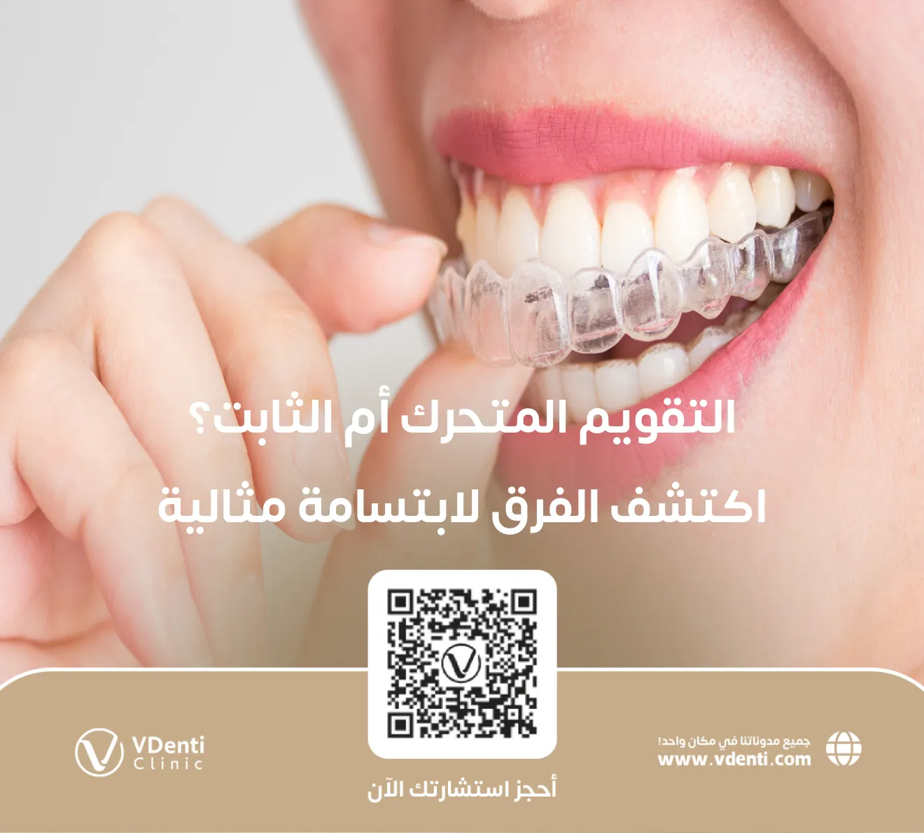 التقويم المتحرك أم الثابت؟ اكتشف الفرق لابتسامة مثالية