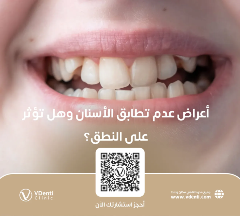 أعراض عدم تطابق الأسنان وهل تؤثر على النطق؟