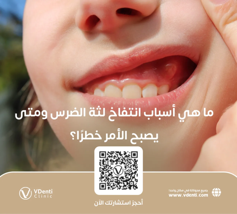 ما هي أسباب انتفاخ لثة الضرس ومتى يصبح الأمر خطرًا؟