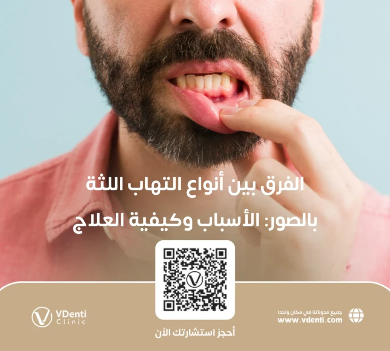 الفرق بين أنواع التهاب اللثة بالصور: الأسباب وكيفية العلاج