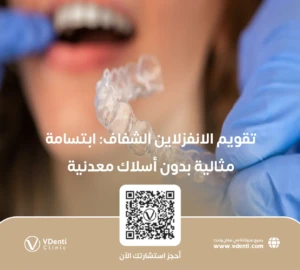 تقويم الانفزلاين الشفاف