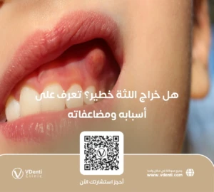 هل خراج اللثة خطير