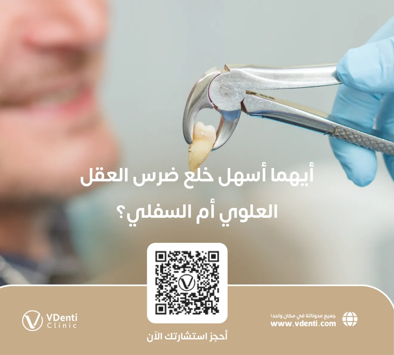 أيهما أسهل خلع ضرس العقل العلوي أم السفلي