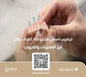 تركيب اسنان متحركة