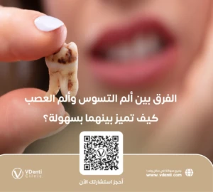 الفرق بين ألم التسوس وألم العصب