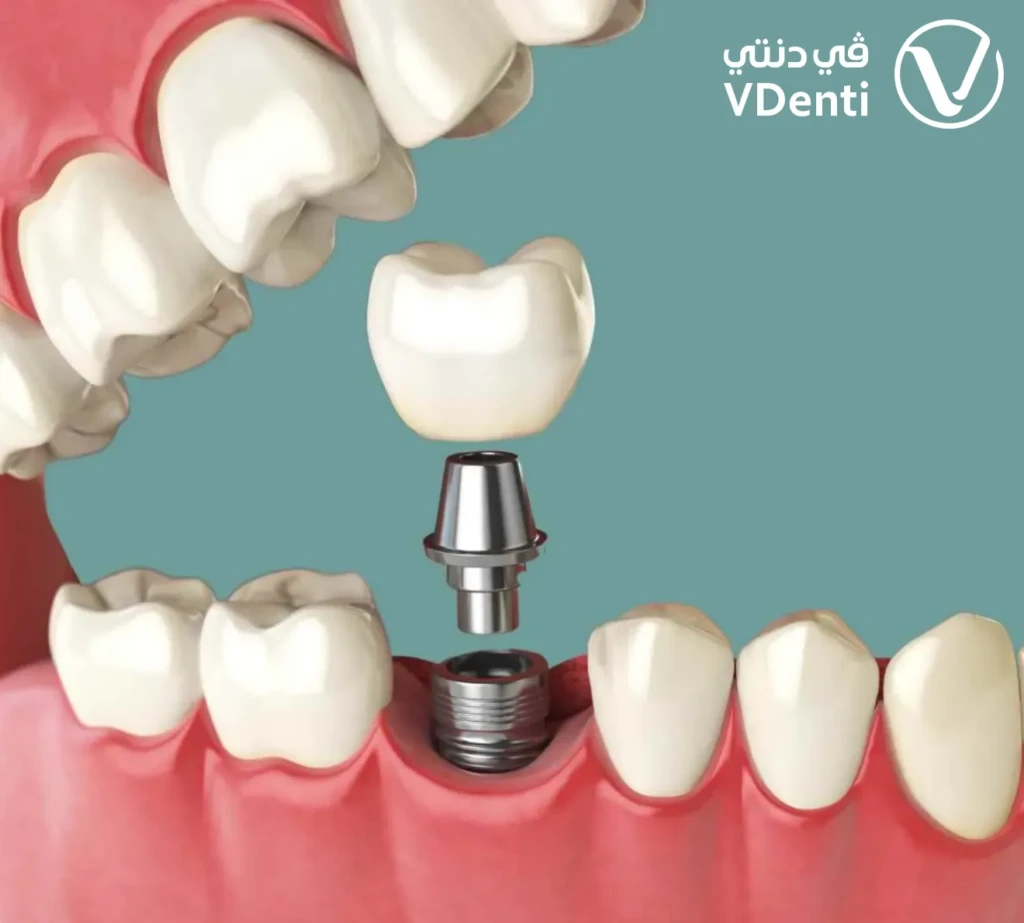 الزراعة التقليدية 