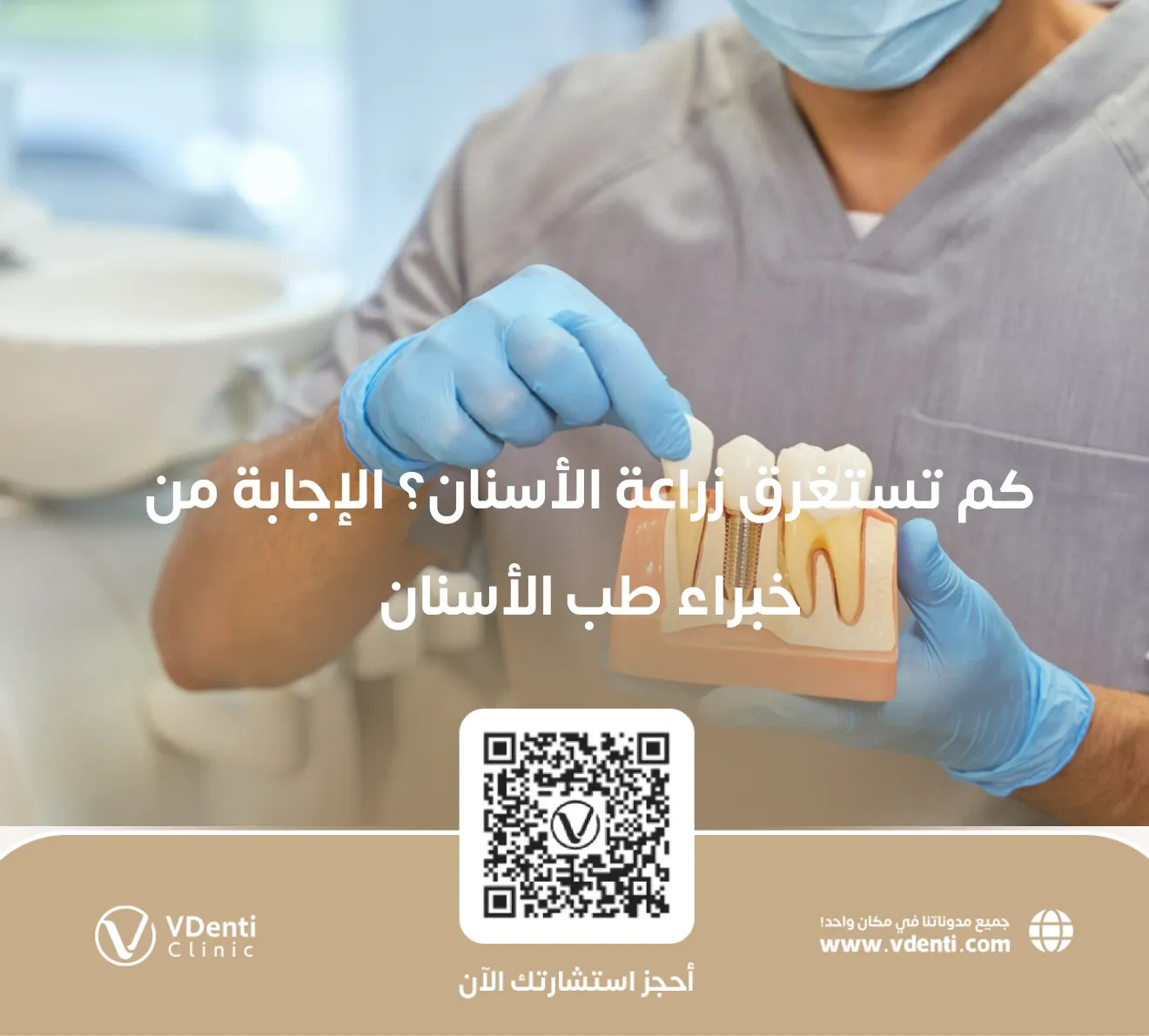 كم تستغرق زراعة الأسنان