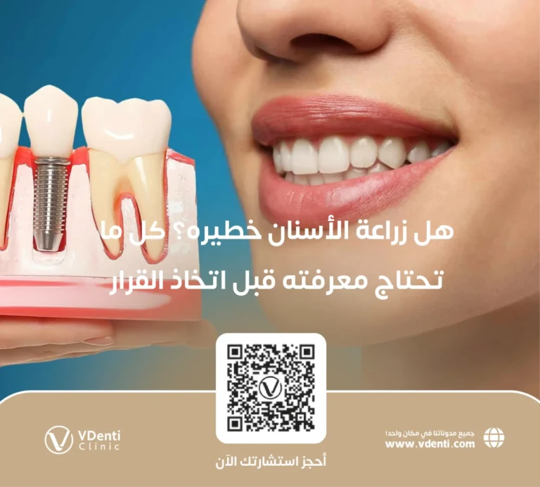 هل زراعة الأسنان خطيره