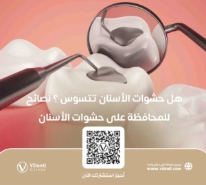 هل حشوات الأسنان تتسوس