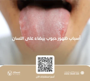 أسباب ظهور حبوب بيضاء على اللسان