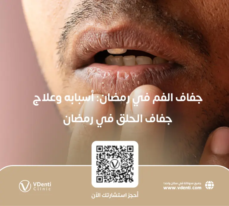 جفاف الفم في رمضان