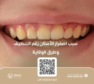 سبب اصفرار الأسنان رغم التنظيف