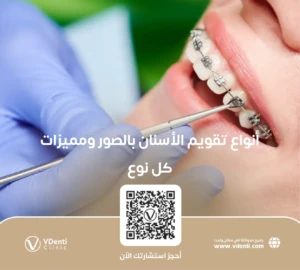 أنواع تقويم الأسنان بالصور ومميزات كل نوع