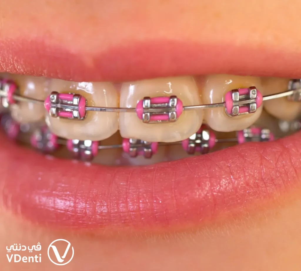 التقويم ذاتي الربط