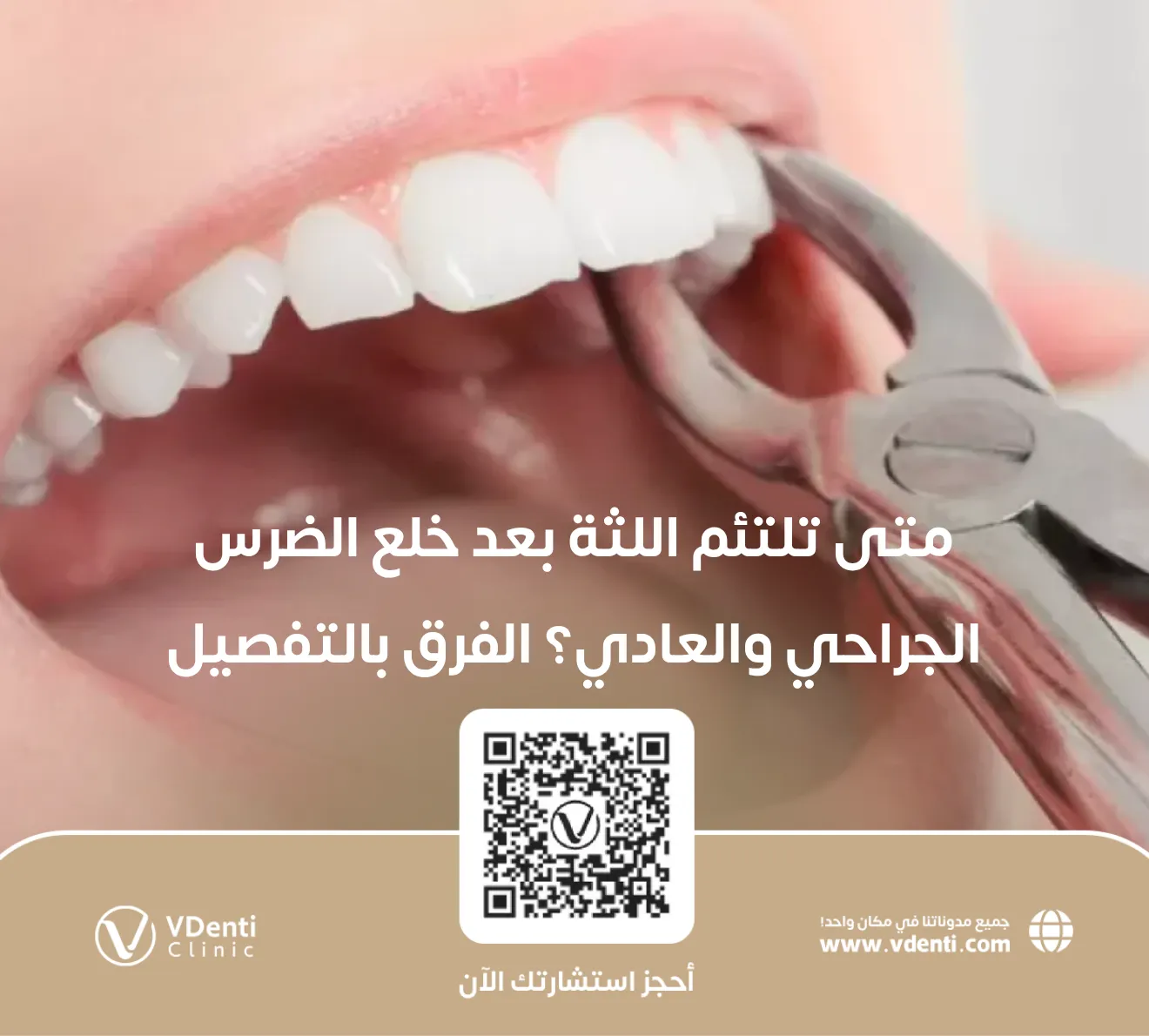 متى تلتئم اللثة بعد خلع الضرس