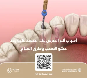 ألم الضرس عند الضغط عليه بعد حشو العصب