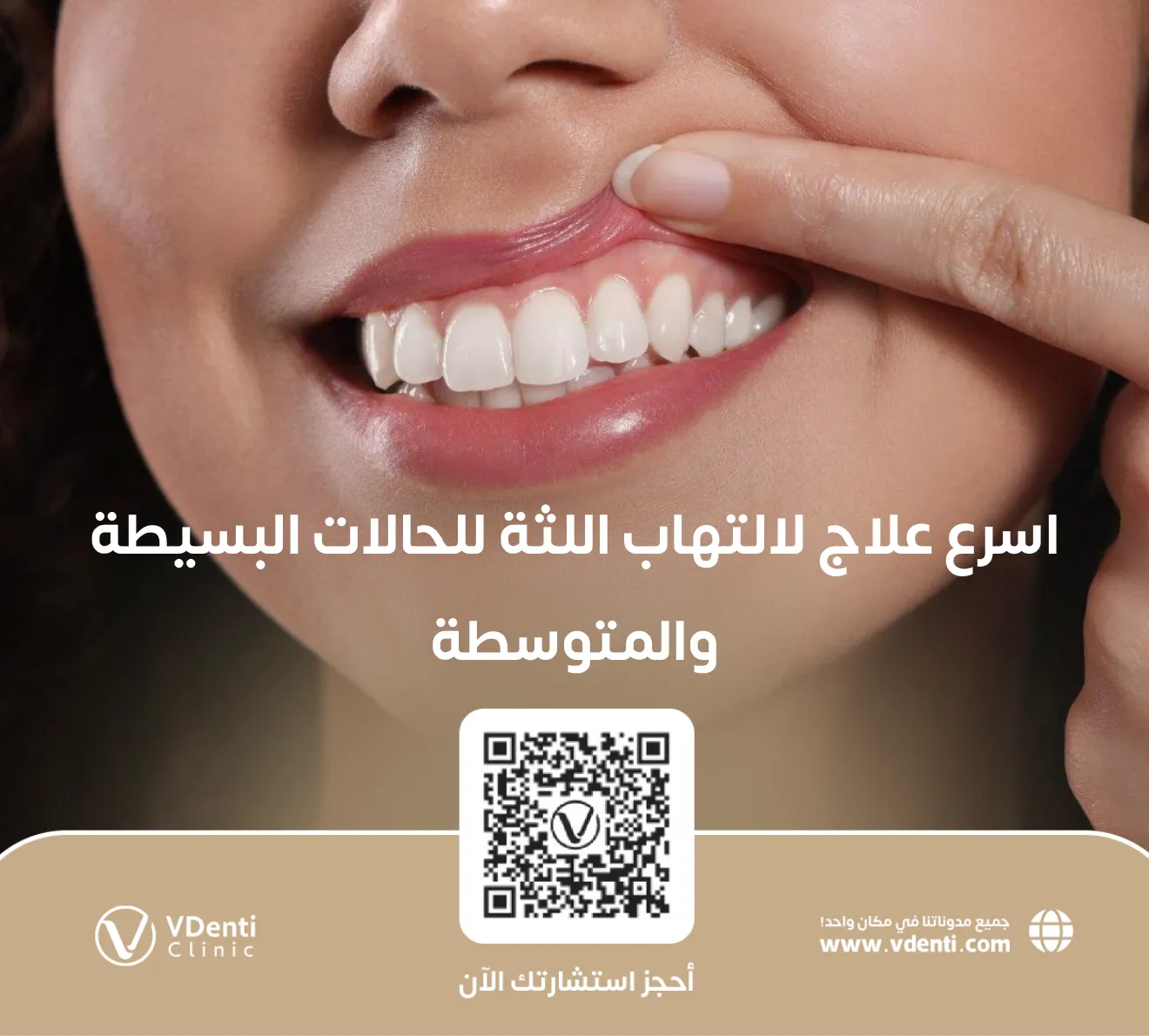اسرع علاج لالتهاب اللثة