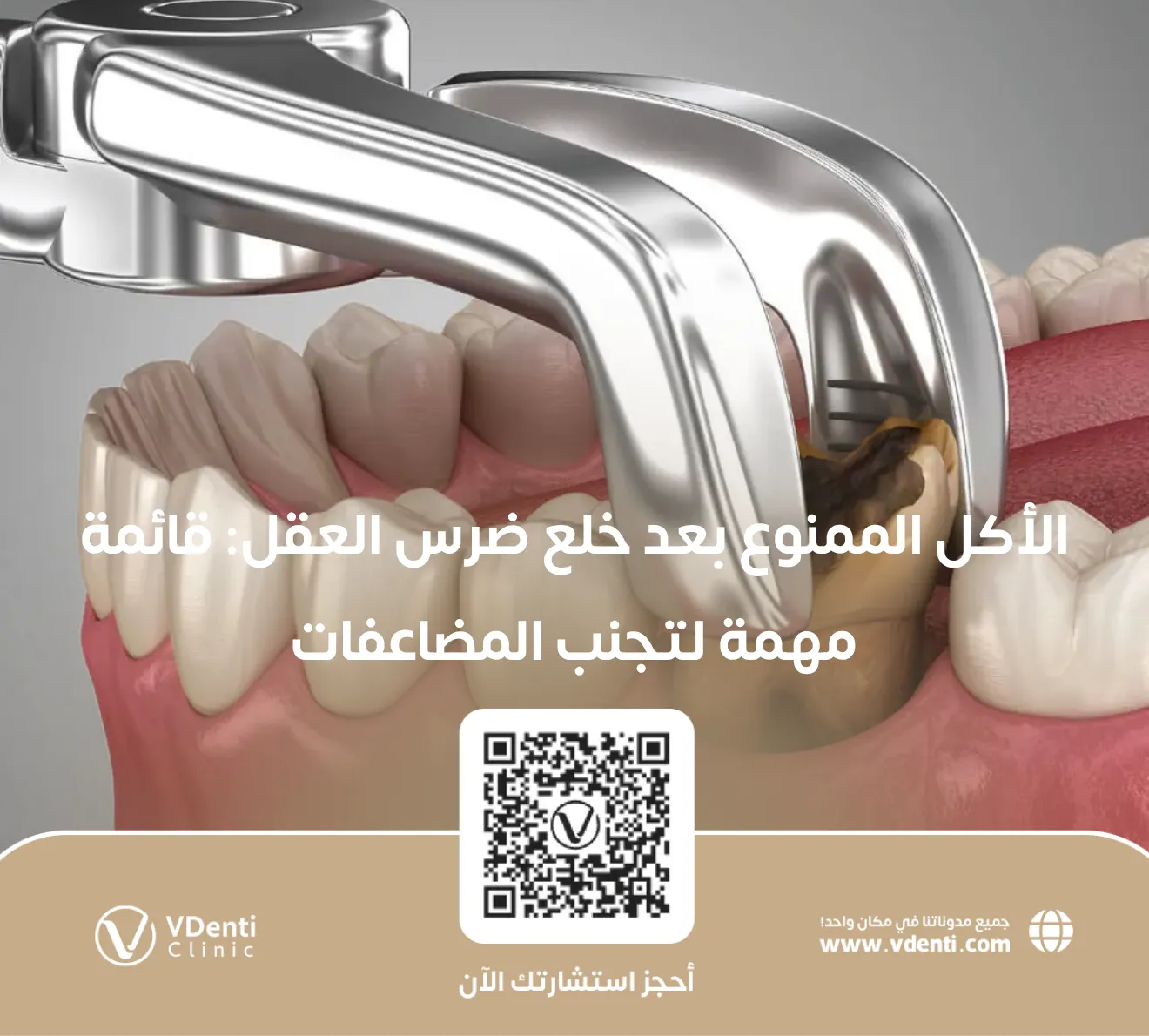 الأكل الممنوع بعد خلع ضرس العقل
