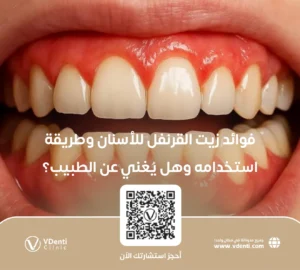 فوائد زيت القرنفل للأسنان