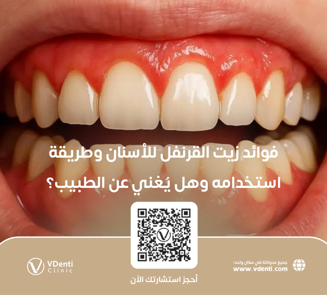 فوائد زيت القرنفل للأسنان