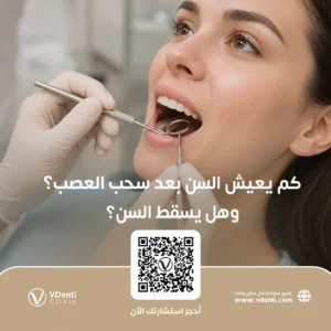 كم يعيش السن بعد سحب العصب
