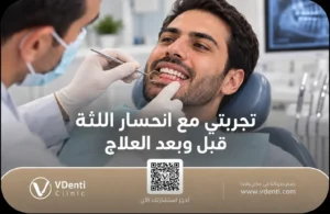 تجربتي مع انحسار اللثة