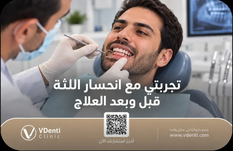 تجربتي مع انحسار اللثة