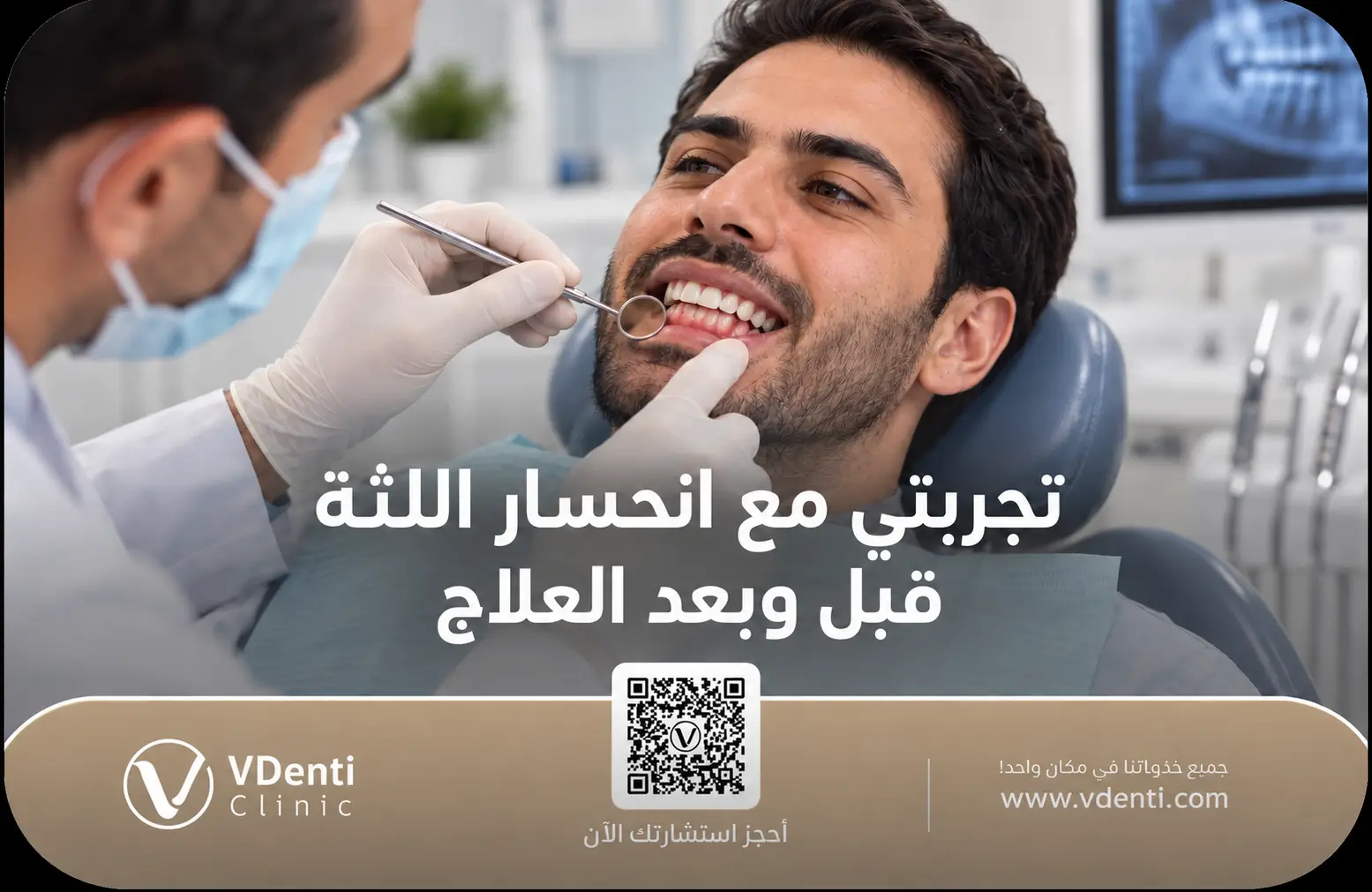 تجربتي مع انحسار اللثة